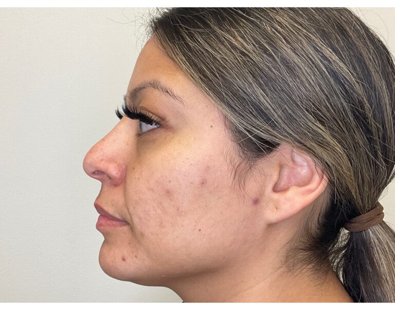 Before Image: Mayra’s Journey - front